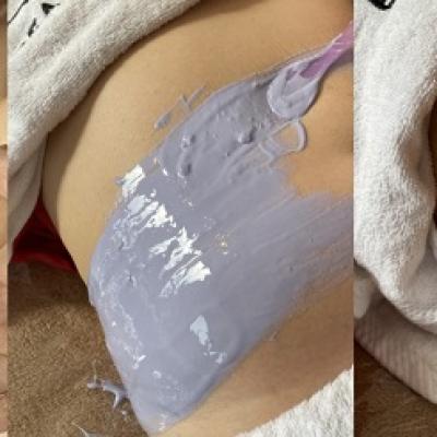 Giải pháp giúp trị liệu giảm mỡ bụng, săn gọn vòng eo hiệu quả và an toàn